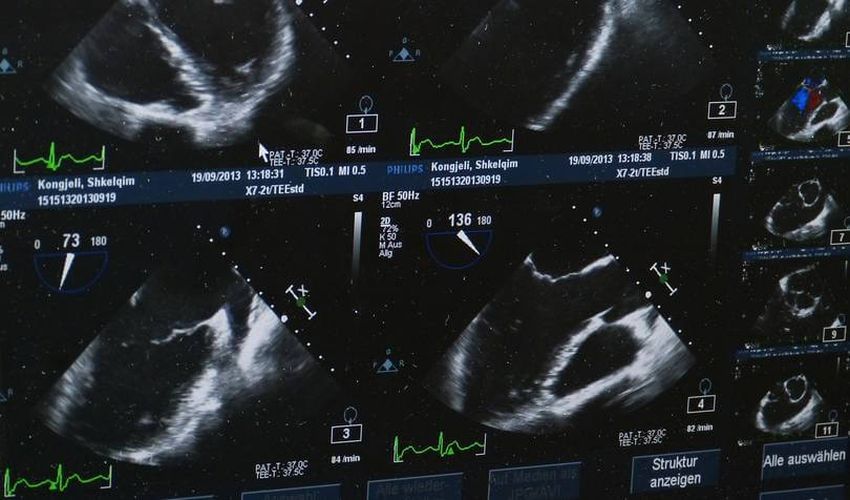 ultrazvučni pregled beograd