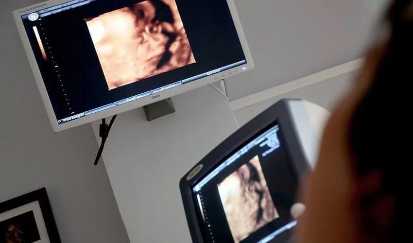 ultrazvuk beograd ultrazvučni pregled dijagnostika