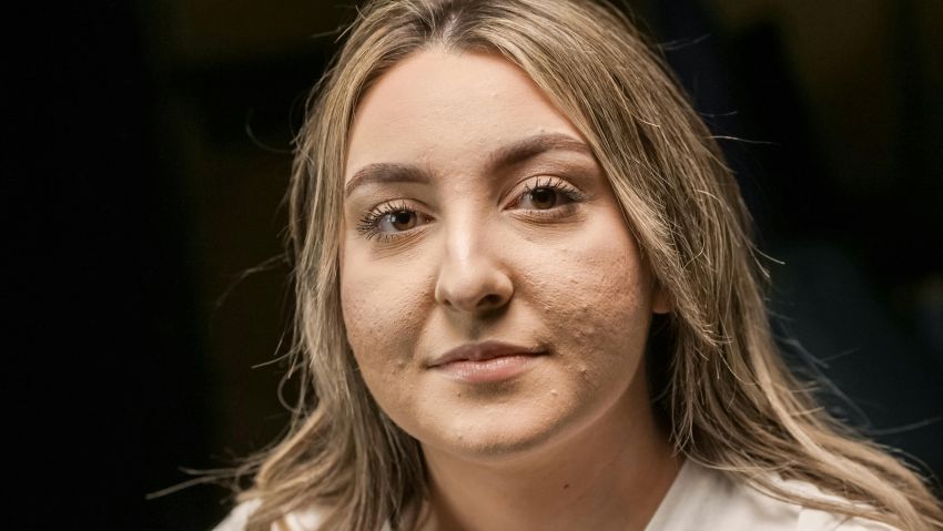 žena sa aknama