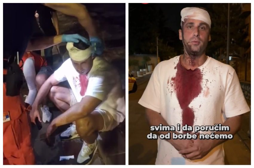 povredjen poslanik ssp pedja mitrović beograd